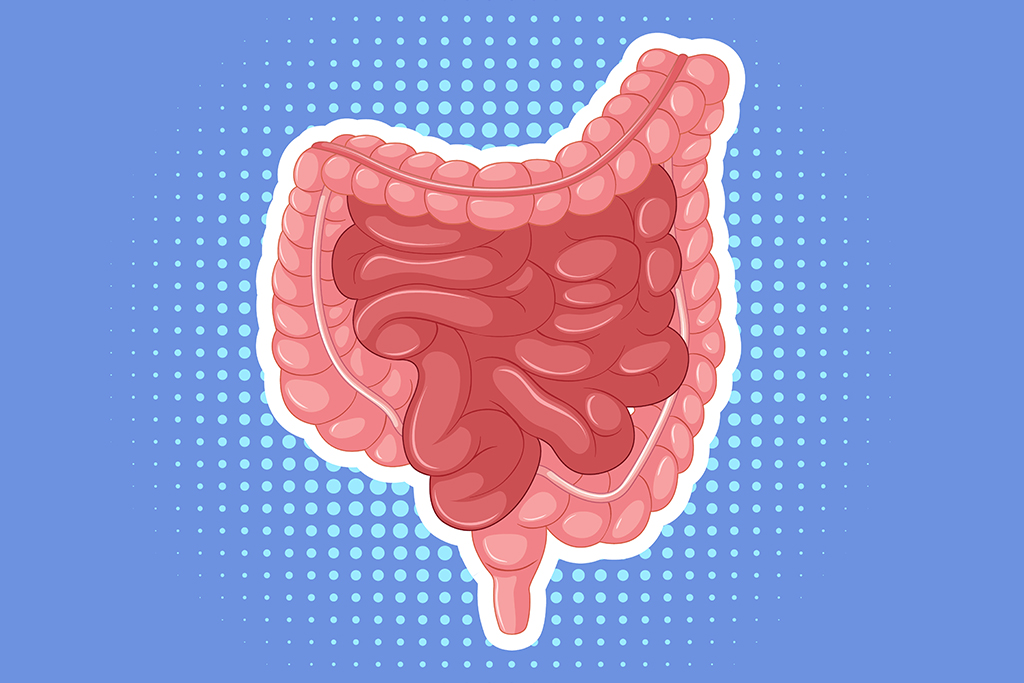 Oclusión intestinal